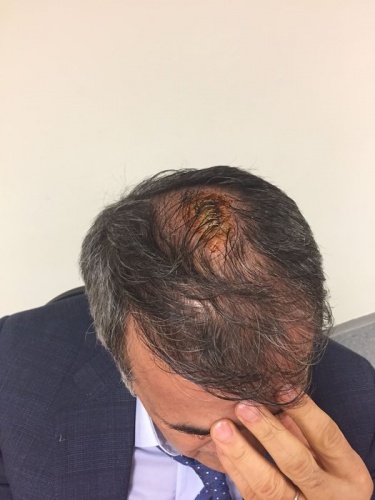 ÇOCUKLUĞUMDAN BERi FUTBOLU KEYiF iÇiN SEÇTiM
GÜNEŞ sözlerine şöyle devam etti: "Olumsuzluklardan ders çıkaralım. Doğru neyse yapılsın. Üzüldük... Çünkü çocukluğumdan beri futbolu keyif için seçtim. Ve keyif almak için yapıyorum bu işi. Nasıl ki bir sanatçı sanatını icra etmek için sahneye çıkıyorsa biz de öyleyiz. Sanatçıya sahnede fiili bir saldırı olduğu zaman sanatını icra edemez. Birini sevmemek ona saldırma hakkını tanımaz".